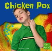 Chicken_pox